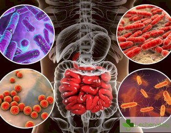 Новооткрити бактерии повишават риска от рак на дебелото черво