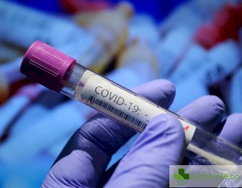 76 нови с COVID-19 у нас, 4300 PCR, 170 са излекуваните