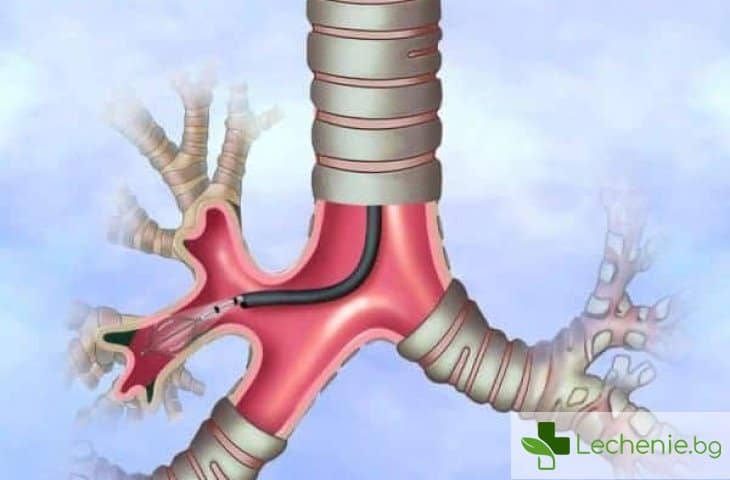 Бронхоскопия - как се прави, показания и противопоказания