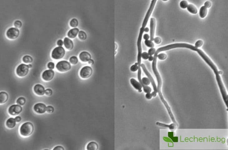 Как да унищожим гъбичката кандида? 