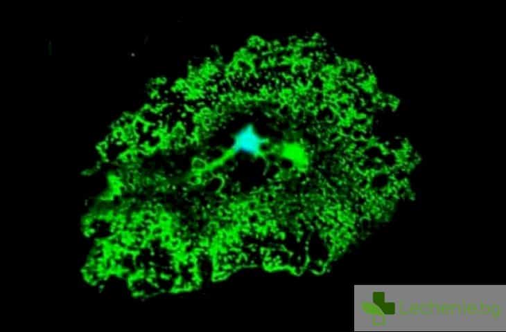 Пробив в лечението на ALS - откриха мозъчни клетки унищожители